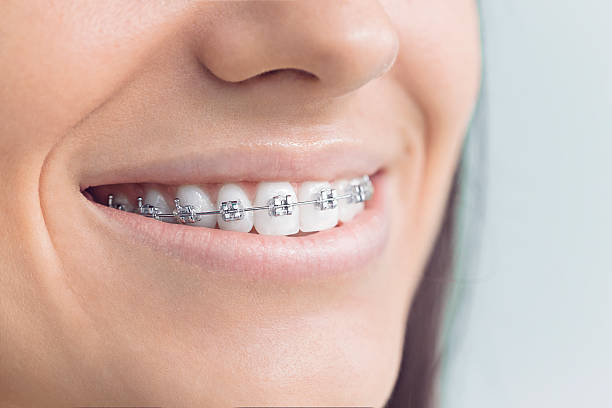 Best Invisalign and Clear Aligners  in Jupiter Farms, FL